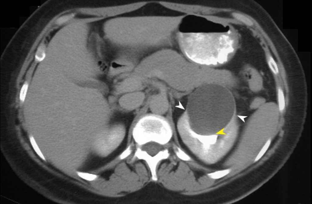 Sign Bird Beak | Kidney